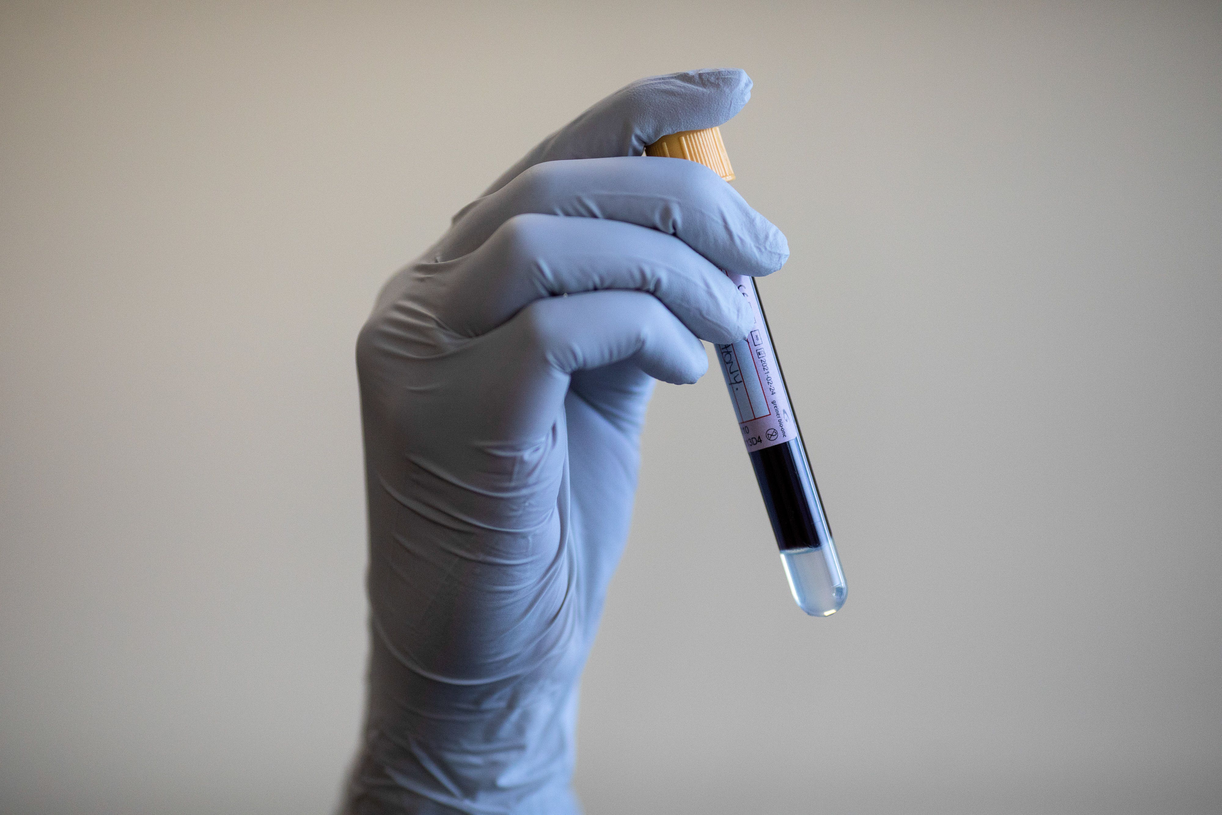 Thousands of patients at risk of developing ovarian cancer could get tests