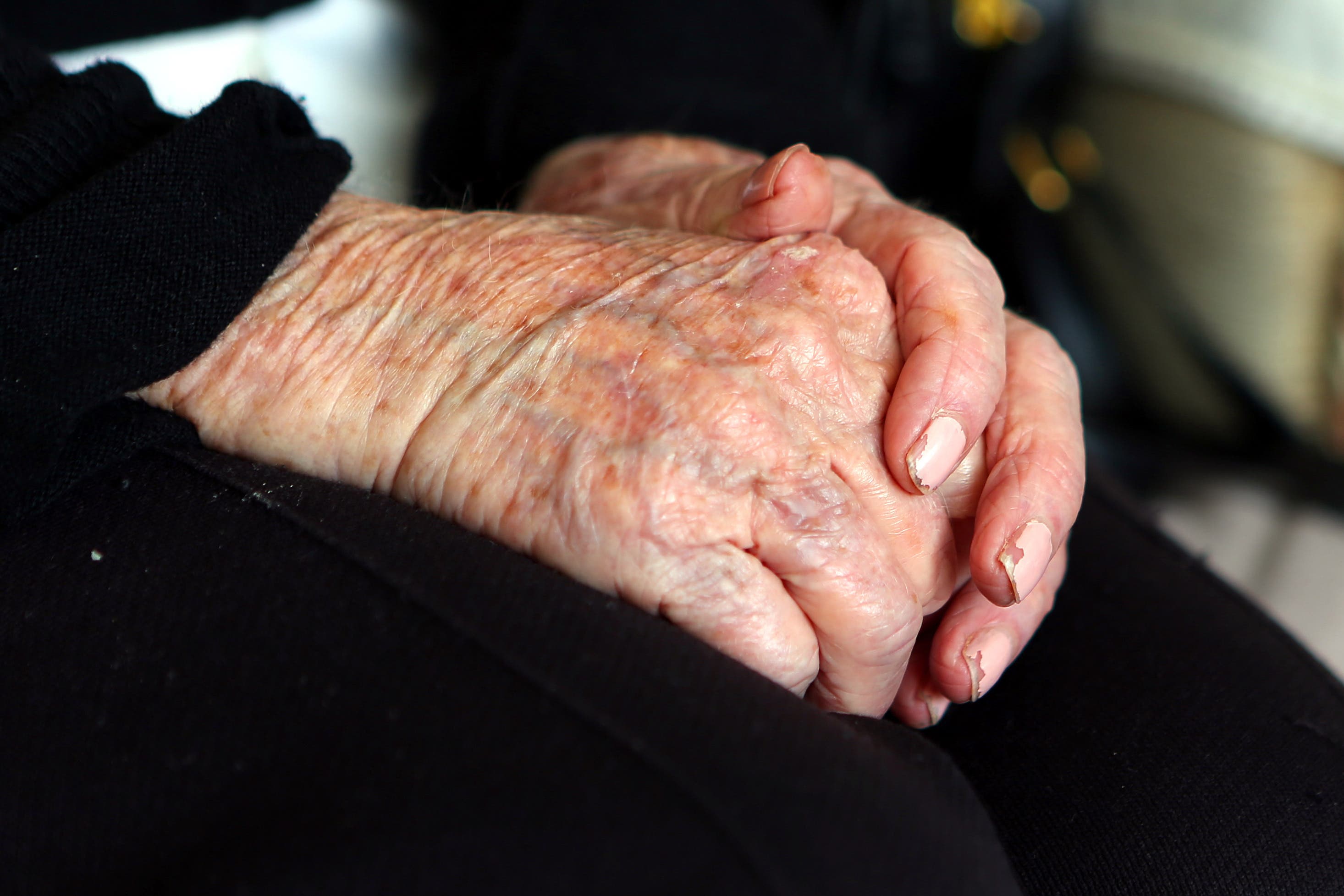 New study is a promising ‘first’ in Alzheimer’s drug development