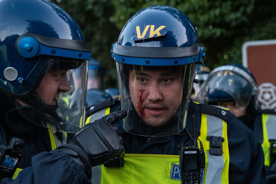 Protests Continue At Epping Migrant Hotel After Police Clashes