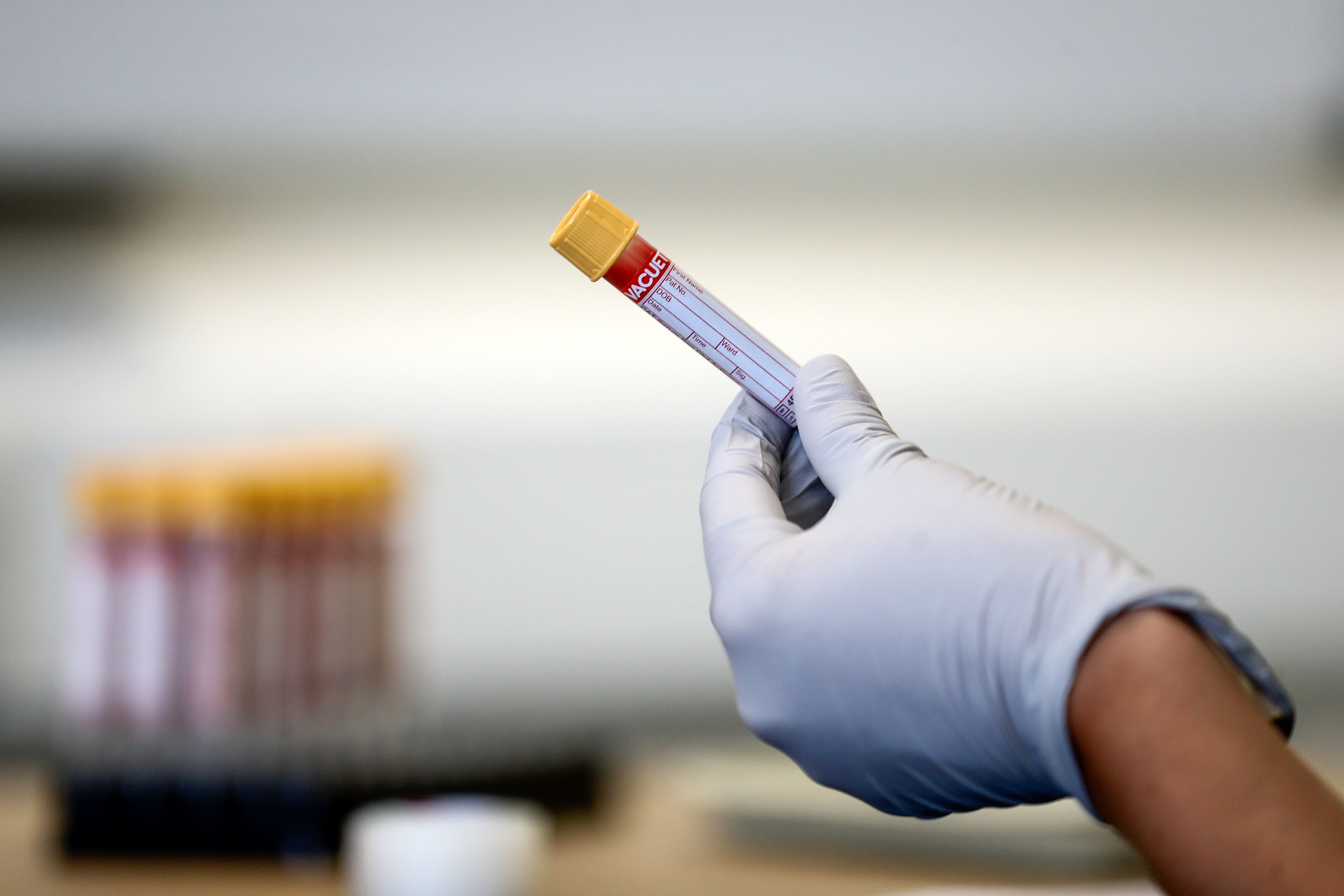 Early detection cancer tests ‘could be part of NHS screening within a decade’