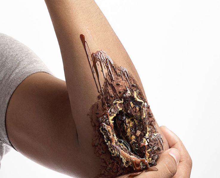 Graphic diabetes campaign shows what excess sugar can do to your body
