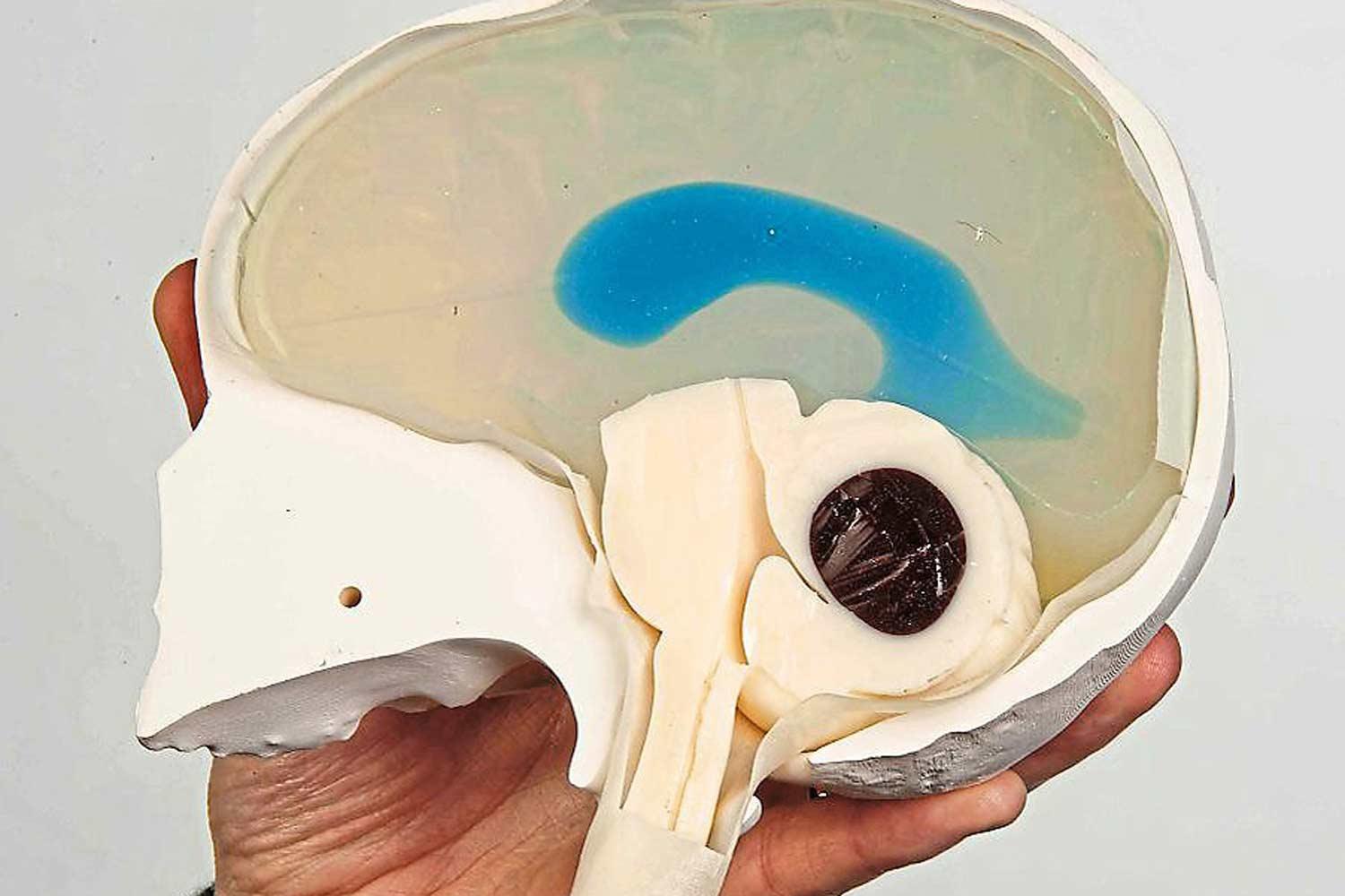 3D toddler skull model will help train surgeons