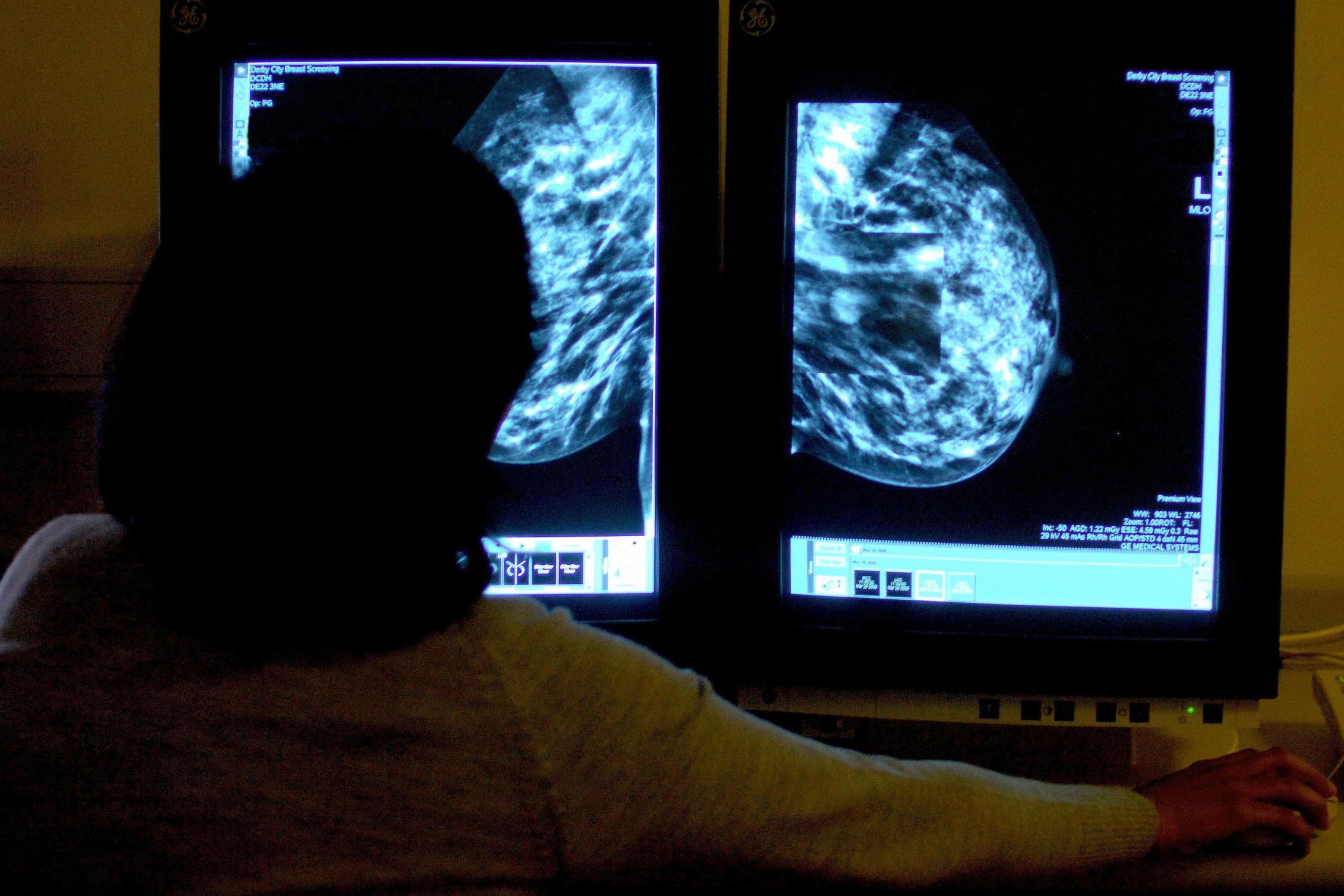 London cancer treatment target missed again despite improvement, says MacMillan